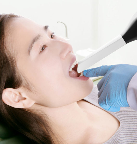 china-intraoral-scanner