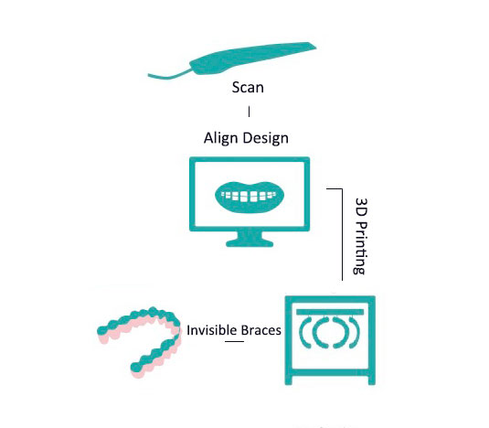 dental-digital-impression-scanner