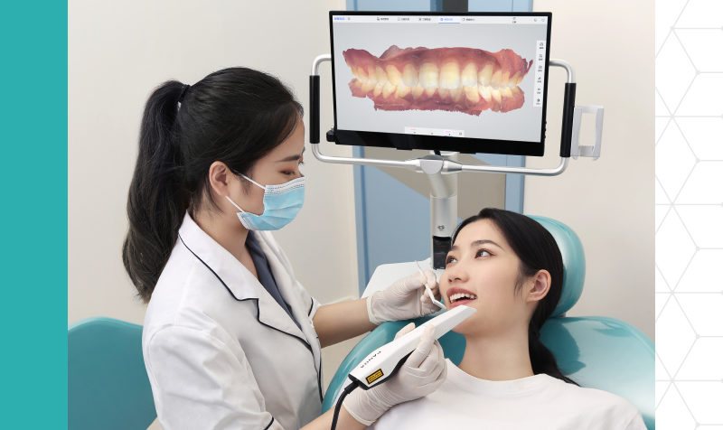 Can you use an intraoral scanner for upper jaw impressions