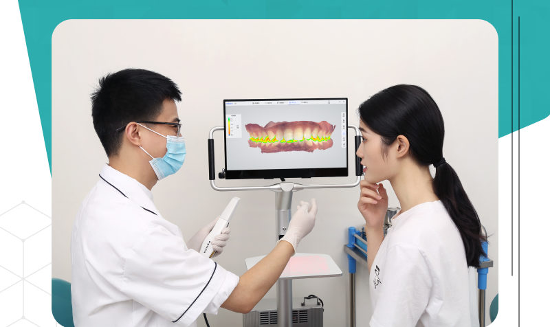 3D dental scanner