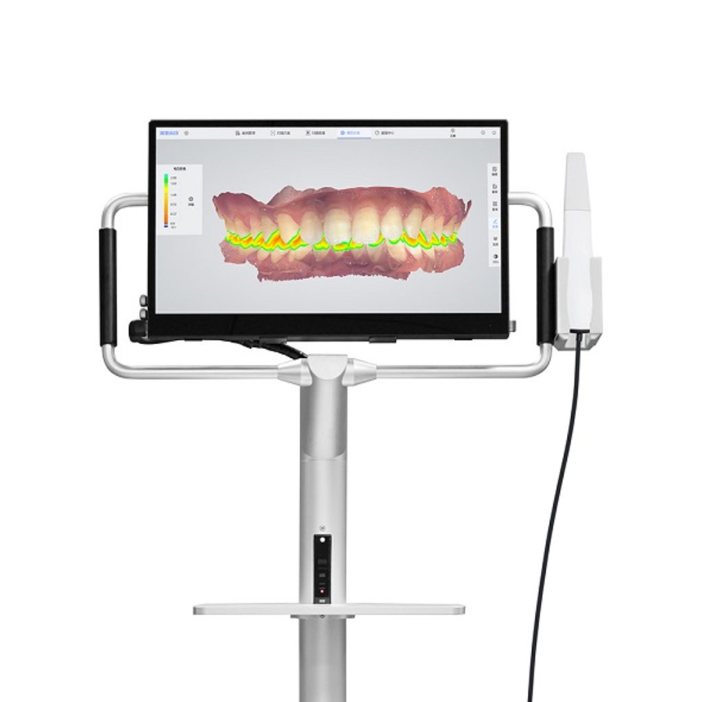 digital-scanner-for-dental-impression