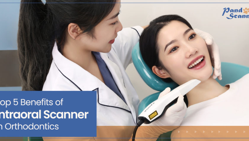 How Dental Intraoral Scanners can Improve Orthodontics - Top 5 Benefits