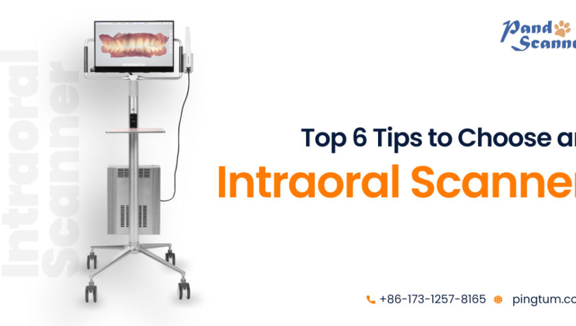 Top 6 Tips on Choosing the Right Intraoral Scanner