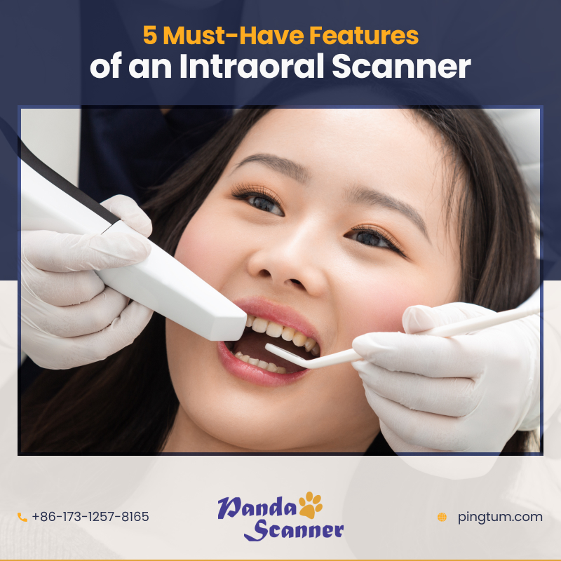 Top 5 Intraoral Scanner Features You Cannot Do Without