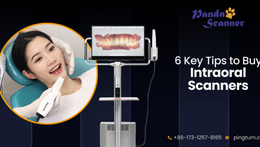 Buying an Intraoral Scanner? Remember These Top 6 Tips