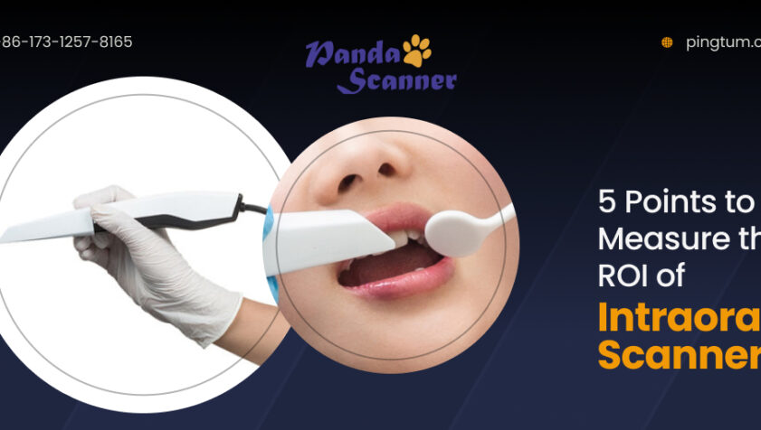 Intraoral Scanners: 5 Points to Measure the Return on Investment
