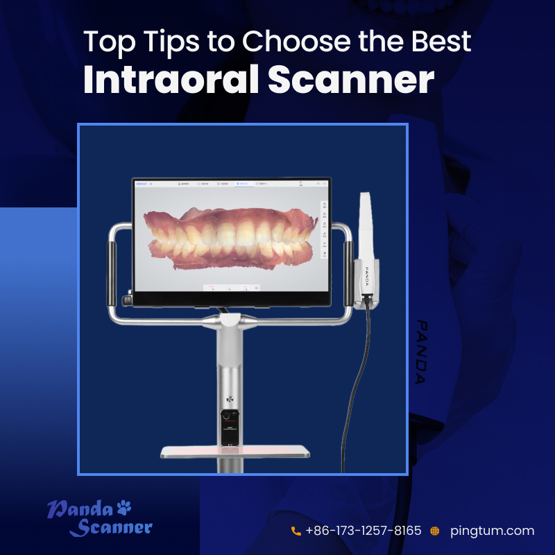 How to Choose the Best Intraoral Scanner for Your Clinic? - Top Tips