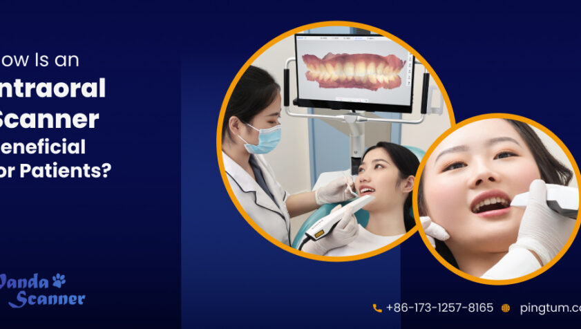 : Top 5 Ways an Intraoral Scanner Is Beneficial for Patients