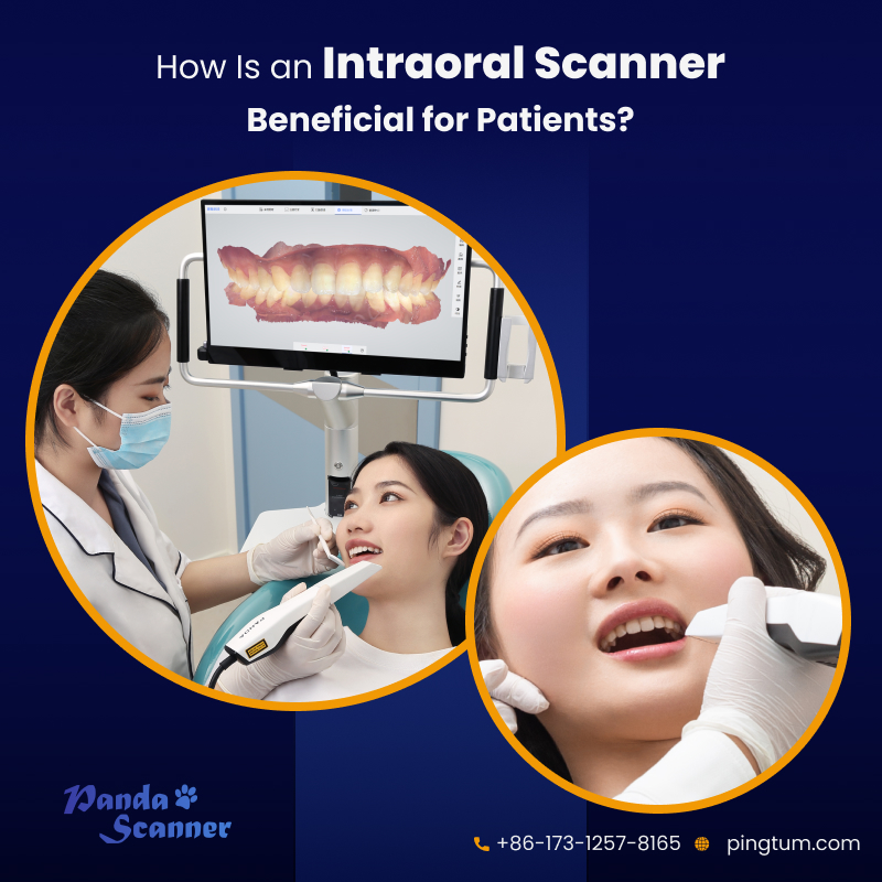Top 5 Ways an Intraoral Scanner Is Beneficial for Patients