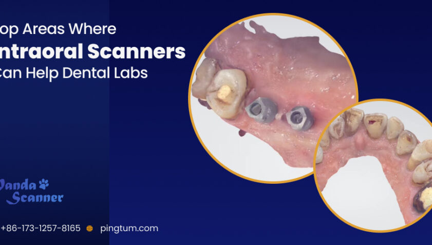 Top Applications of Intraoral Scanners in the Dental Laboratories